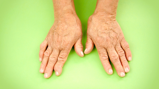 Ayurveda Treatment For Arthritis