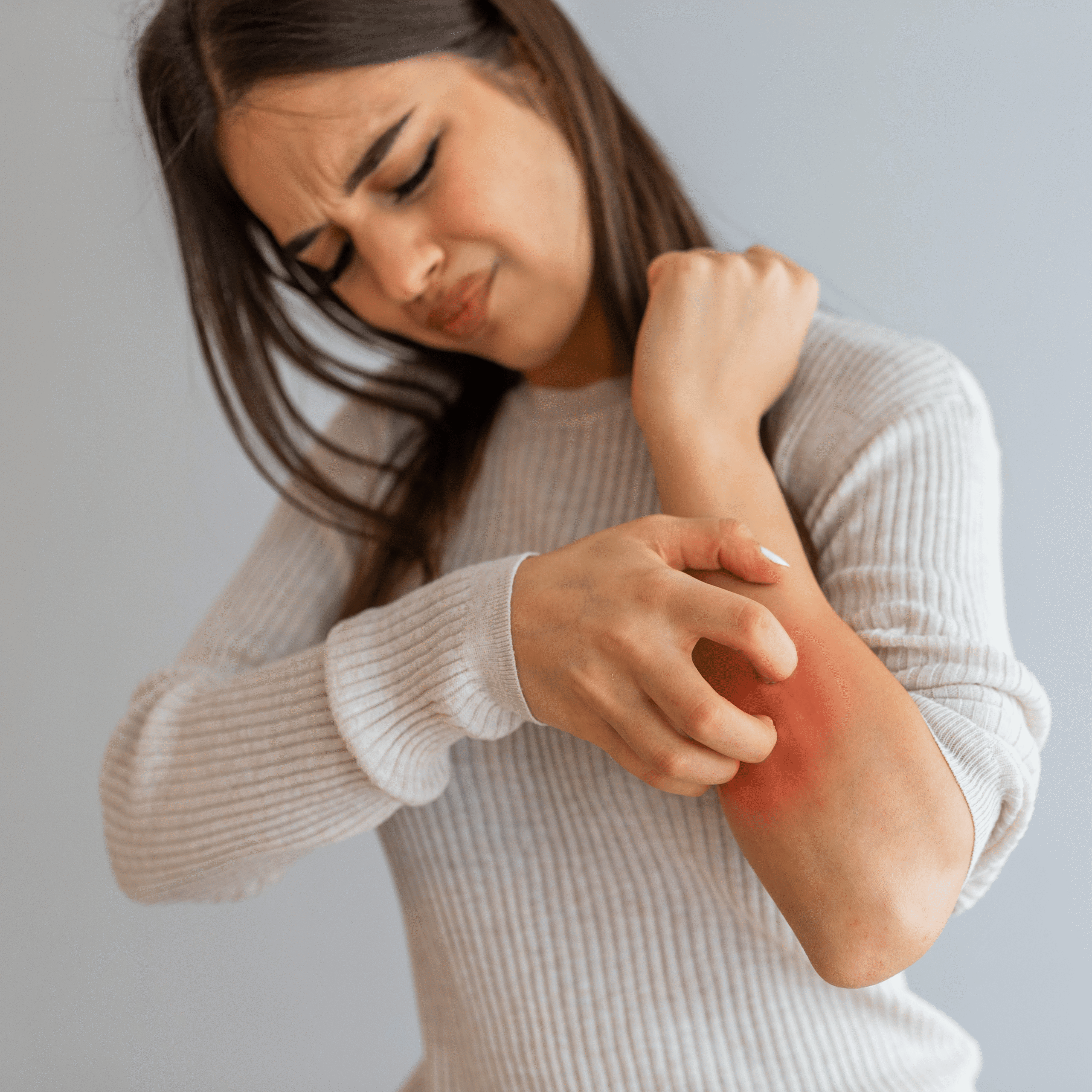 Ayurvedic Treatment for Skin Diseases Helps You Heal Naturally A woman scratching her red, irritated skin on the elbow, showing signs of itching and inflammation.